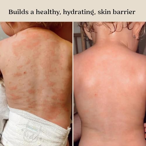 Fragrance Free Baby Lotion for Sensitive Skin Lightweight Care